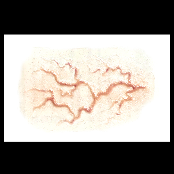 transfers_Veins